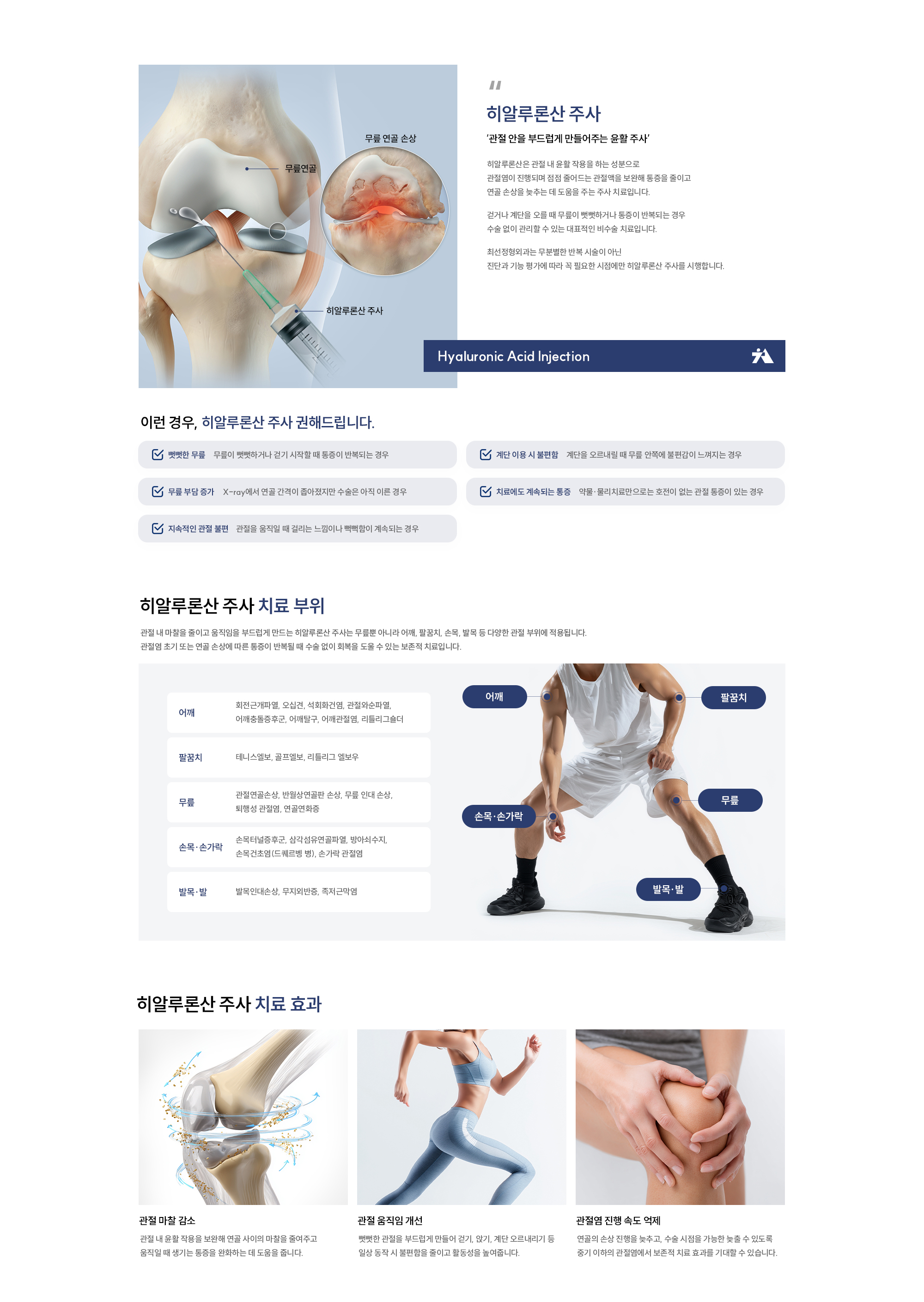 히알루론산 주사