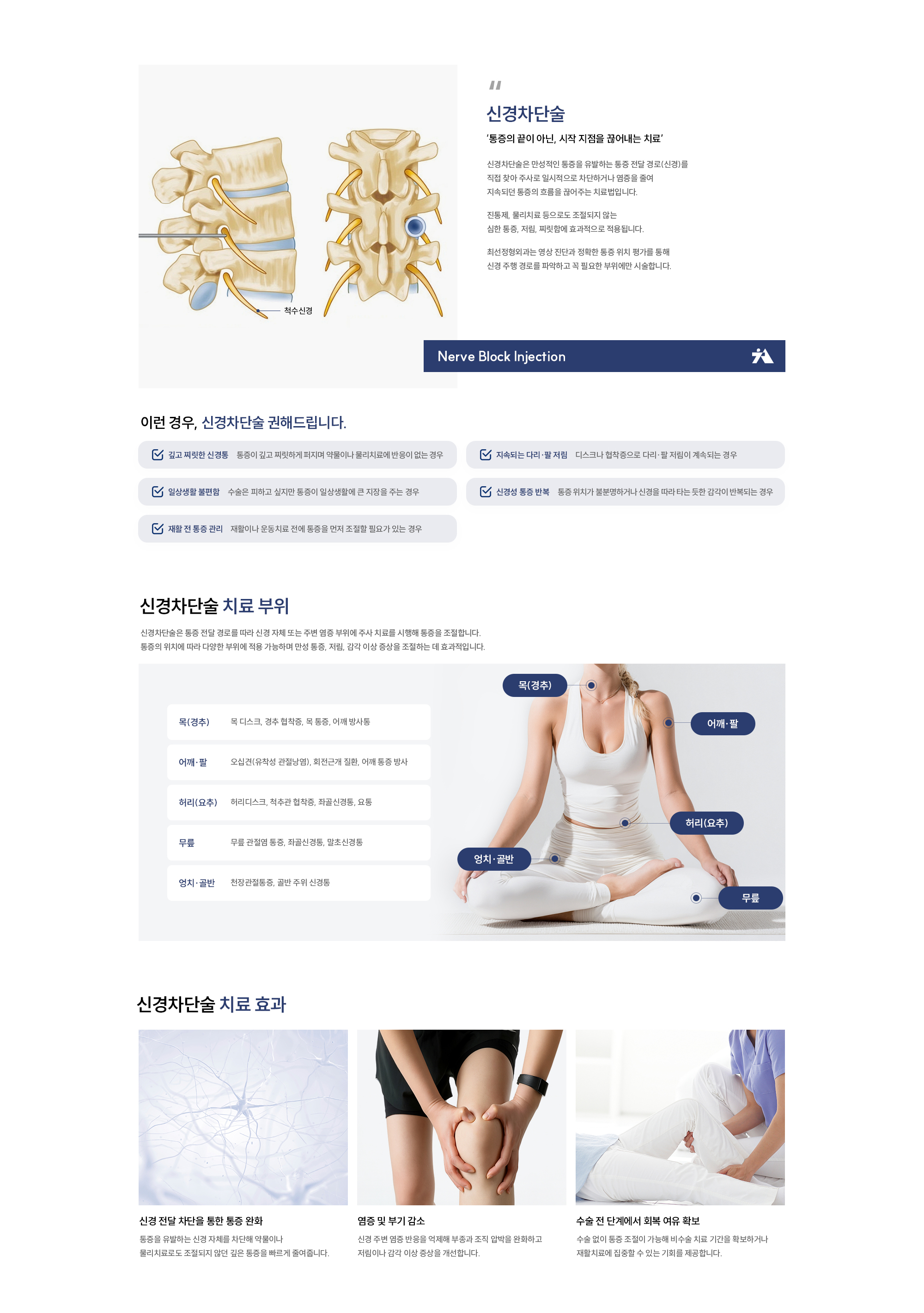 신경차단술